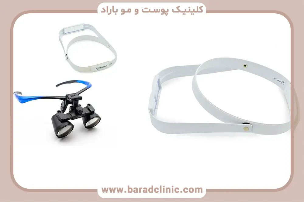 مزایای لوپ کاشت مو