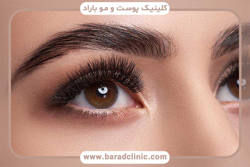 کاشت ابرو طبیعی
