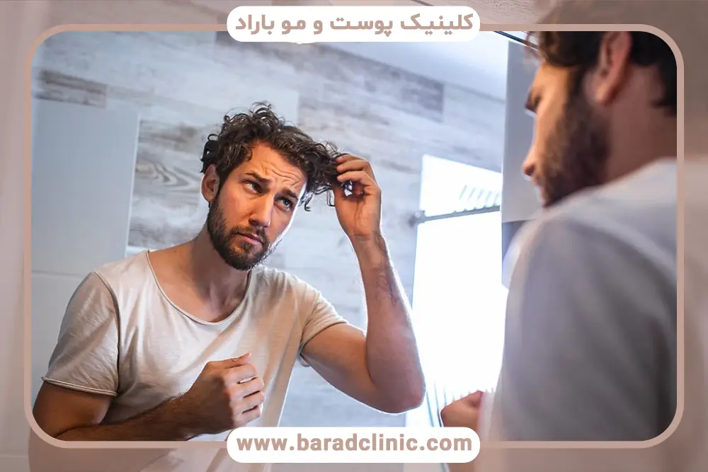 ماندگاری اسپری کاشت موقت مو 