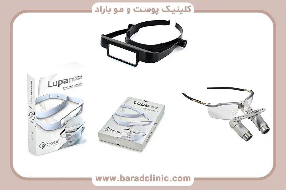 انواع لوپ کاشت مو