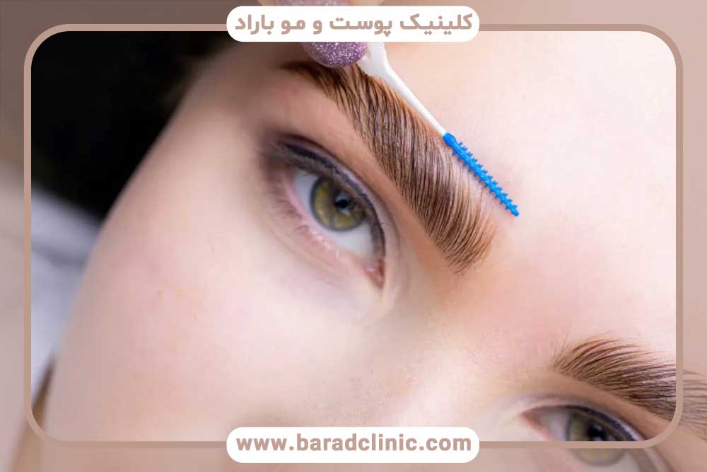 آمپول بیوتین بعد از کاشت ابرو