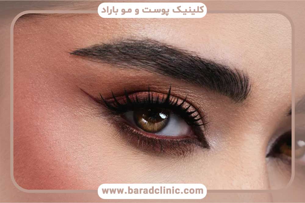 فرآیند ترمیم کاشت ابرو