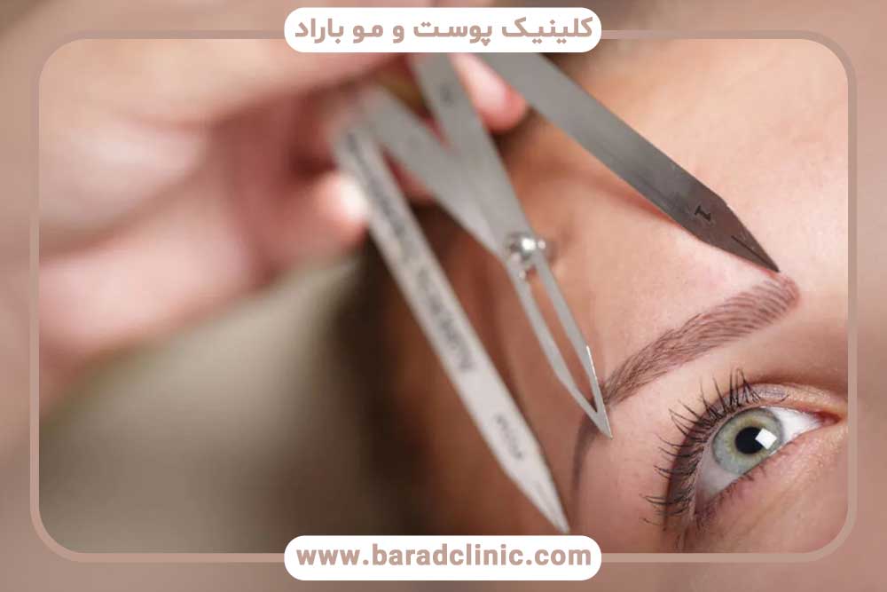 فرآیند ترمیم کاشت ابرو
