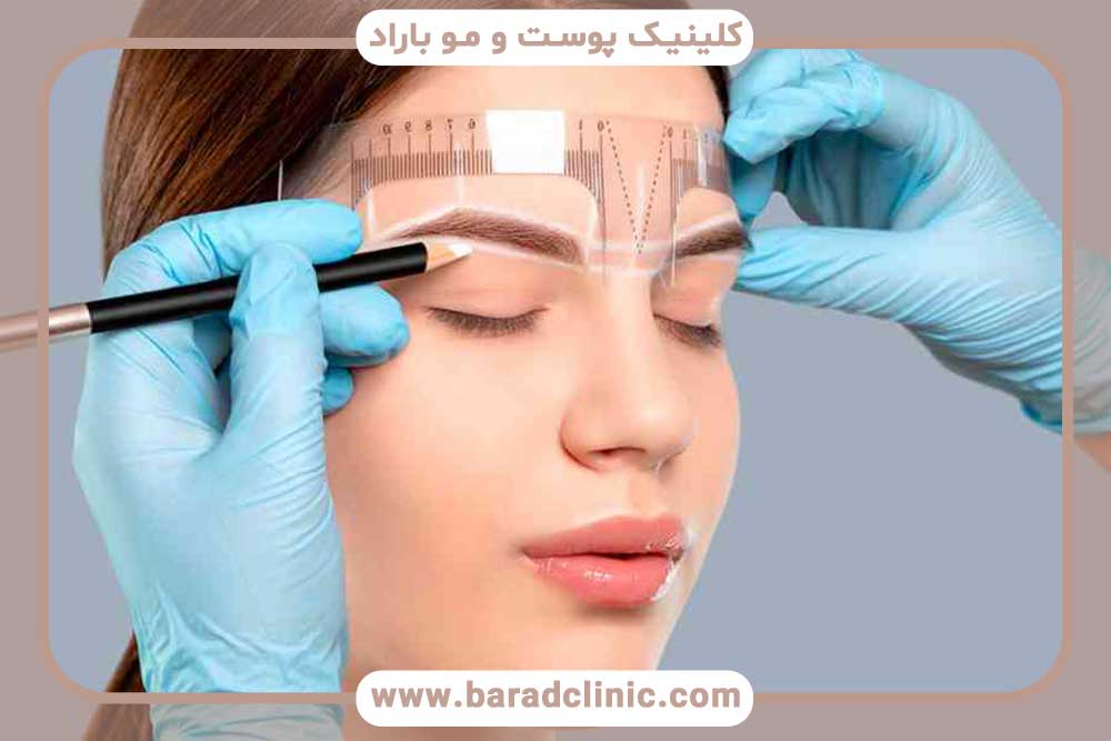 جراحی کاشت ابرو