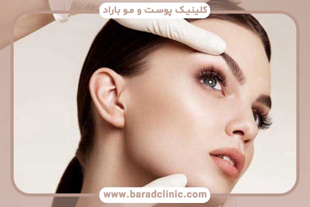 جوش بعد از کاشت ابرو