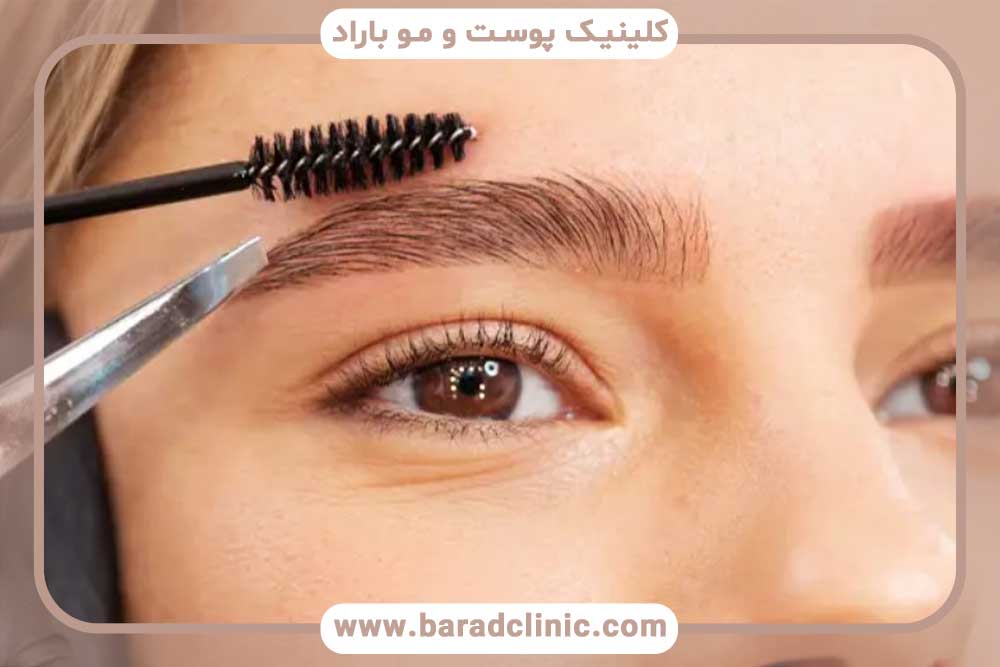 ریزش ابرو بعد از کاشت