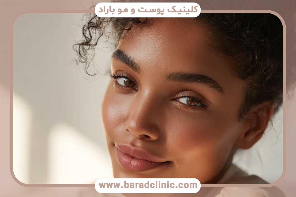 میکرو کاشت ابرو قسطی