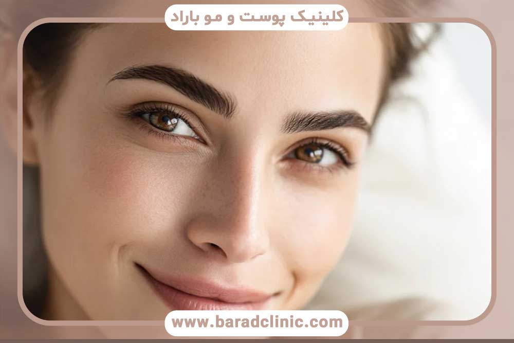 میکرو کاشت ابرو قسطی