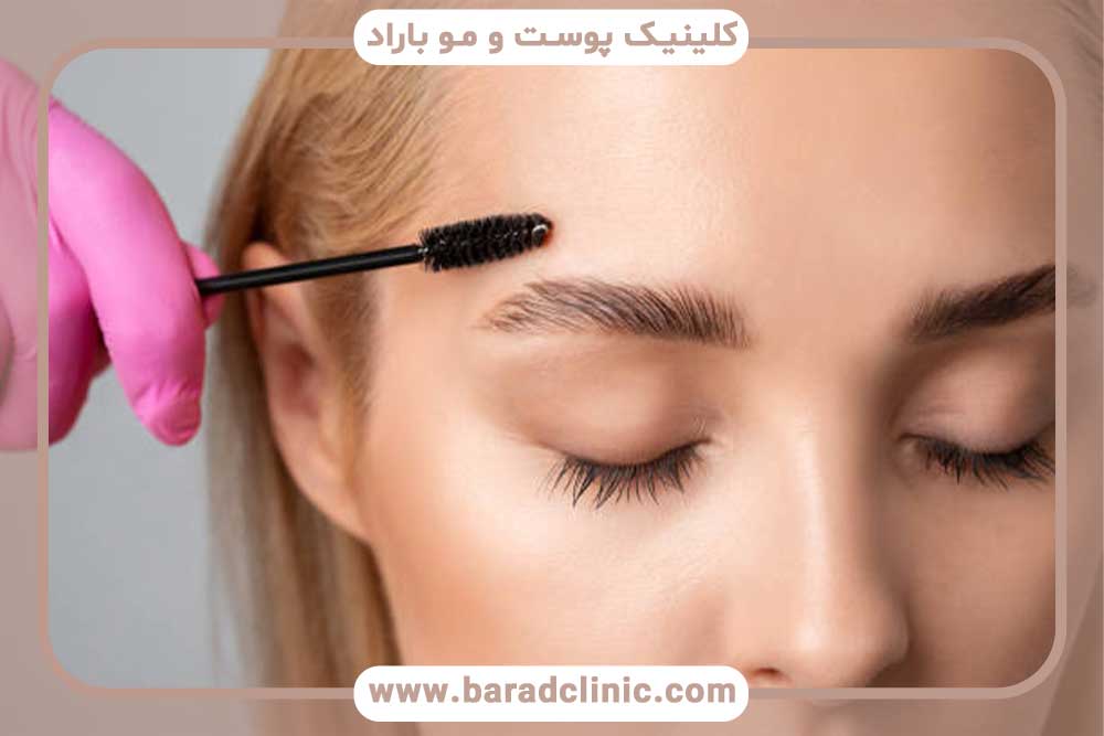 قیمت کاشت ابرو در ایران