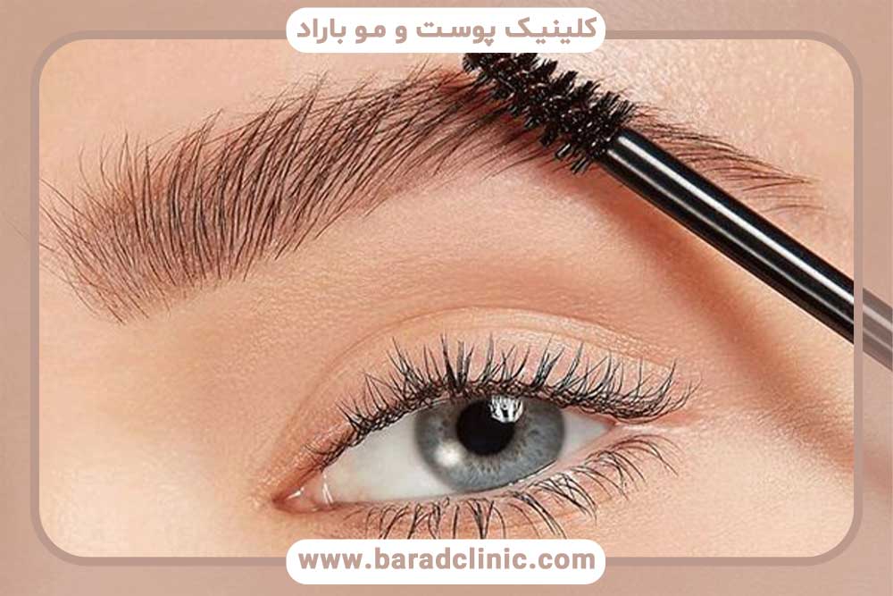 قیمت کاشت ابرو در ایران