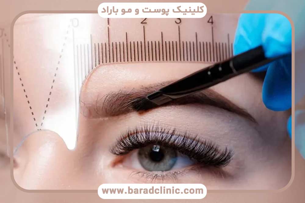 قیمت کاشت ابرو در ایران