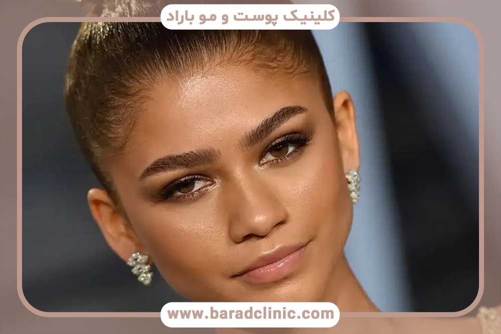 مدل کاشت ابرو