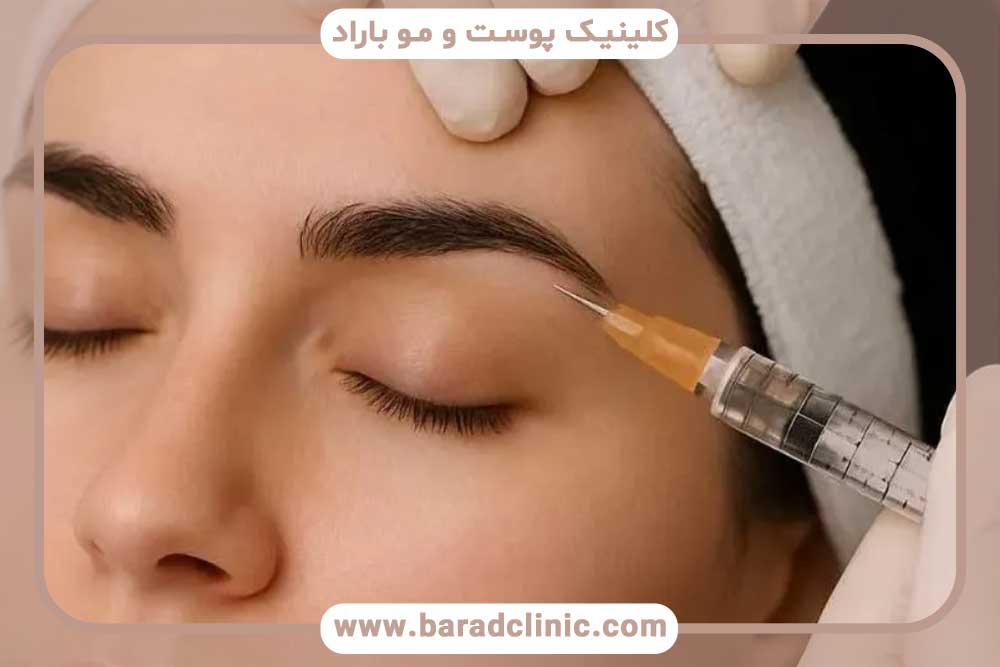 بهترین زمان مزوتراپی بعد از کاشت ابرو