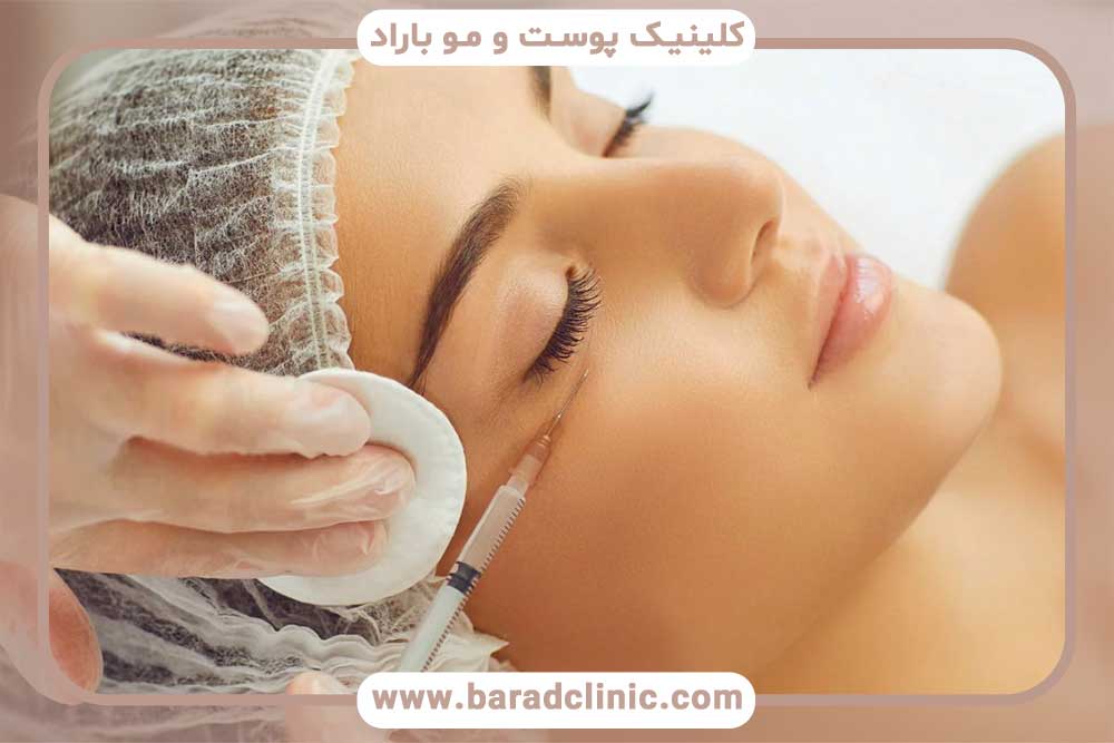 بهترین زمان مزوتراپی بعد از کاشت ابرو