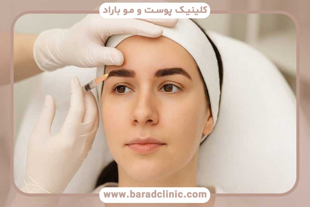 مزوتراپی بعد از کاشت ابرو