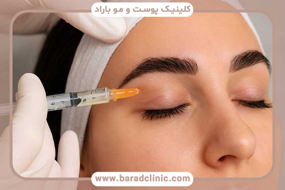 بهترین زمان مزوتراپی بعد از کاشت ابرو