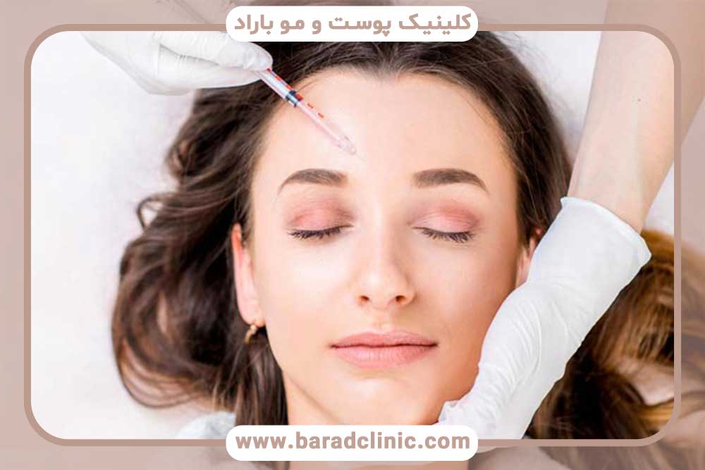 مزوتراپی بعد از کاشت ابرو