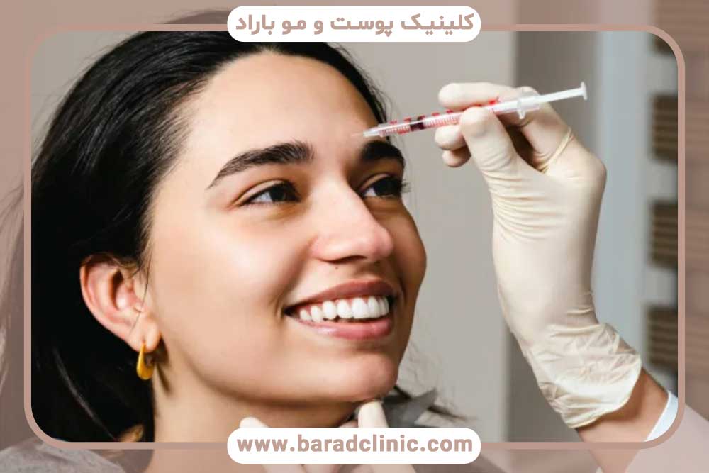 مزوتراپی بعد از کاشت ابرو