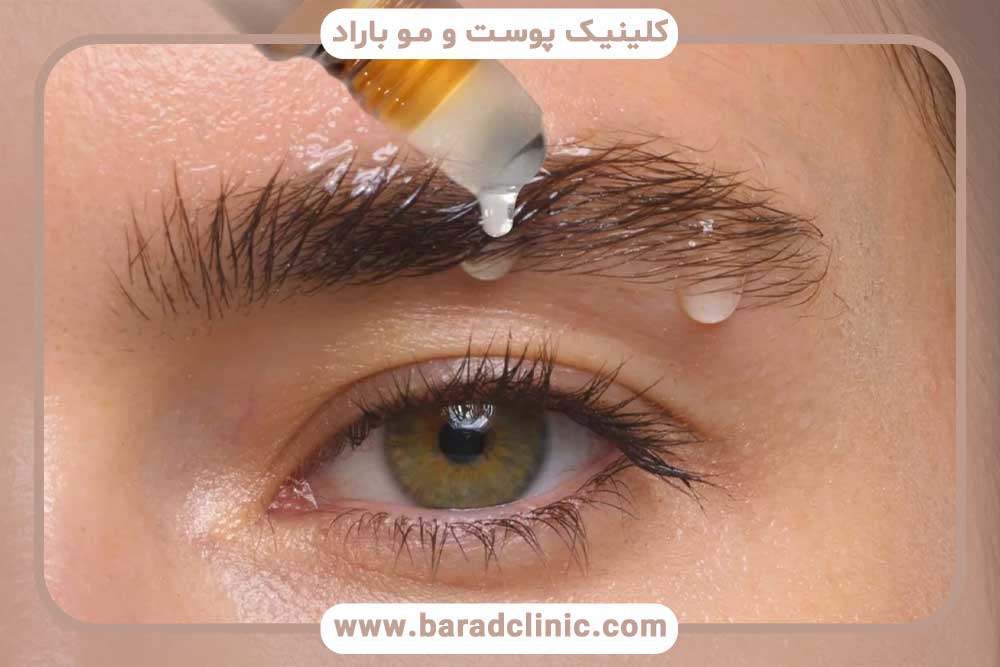 آمپول بیوتین بعد از کاشت ابرو