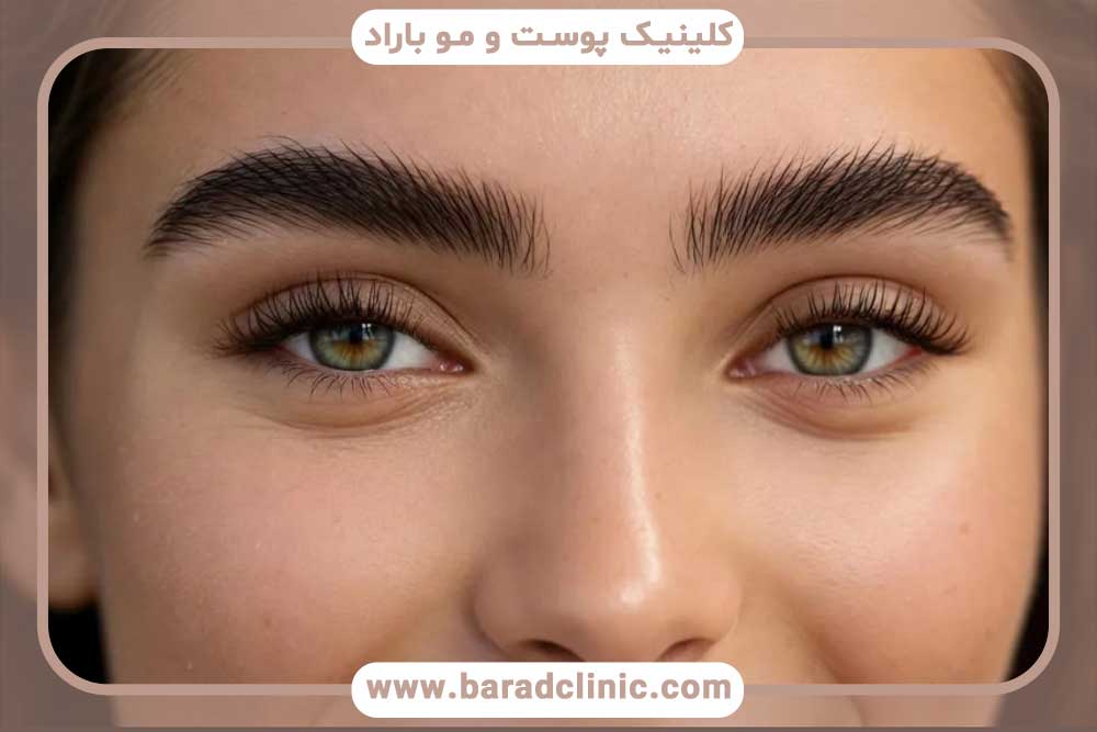 هزینه میکرو کاشت ابرو