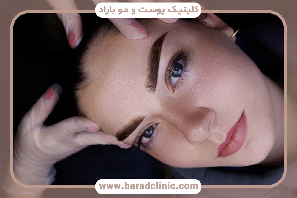 نتیجه نهایی کاشت ابرو
