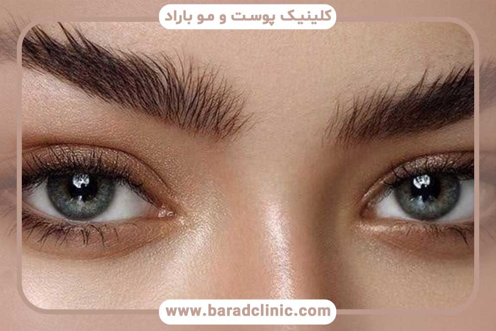 نگهداری ابرو بعد از کاشت