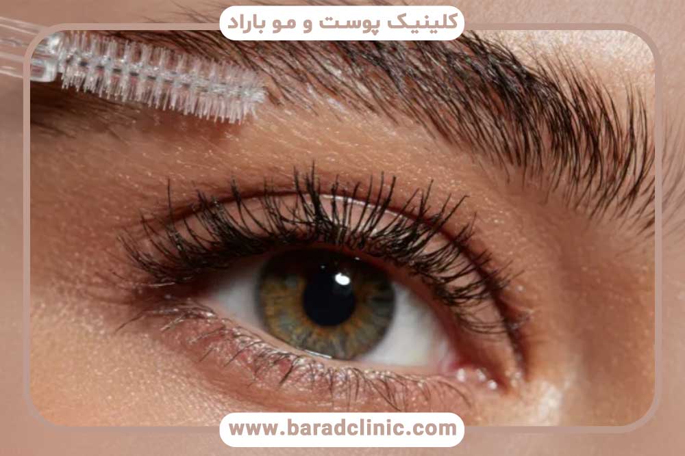 کاشت ابرو بعد از یک ماه