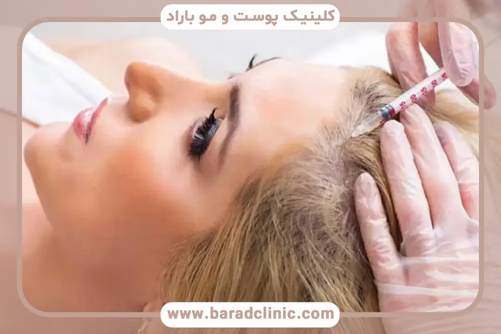 بهترین کیت prp