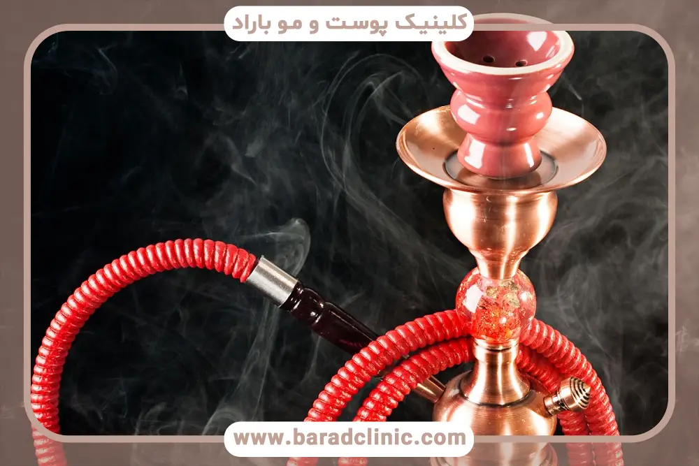 قلیان بعد از کاشت مو