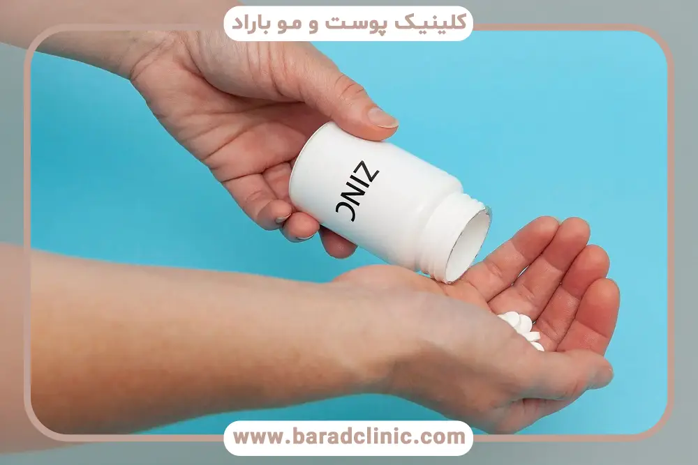 زمان مصرف قرص زینک بعد از کاشت مو