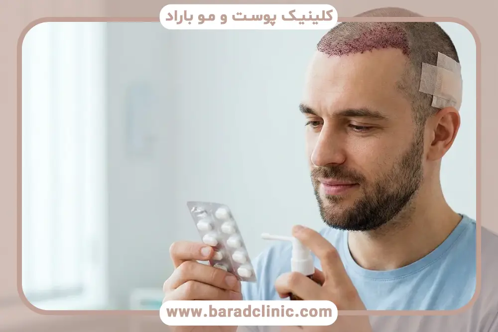 بهترین داروهای تقویتی بعد از کاشت مو