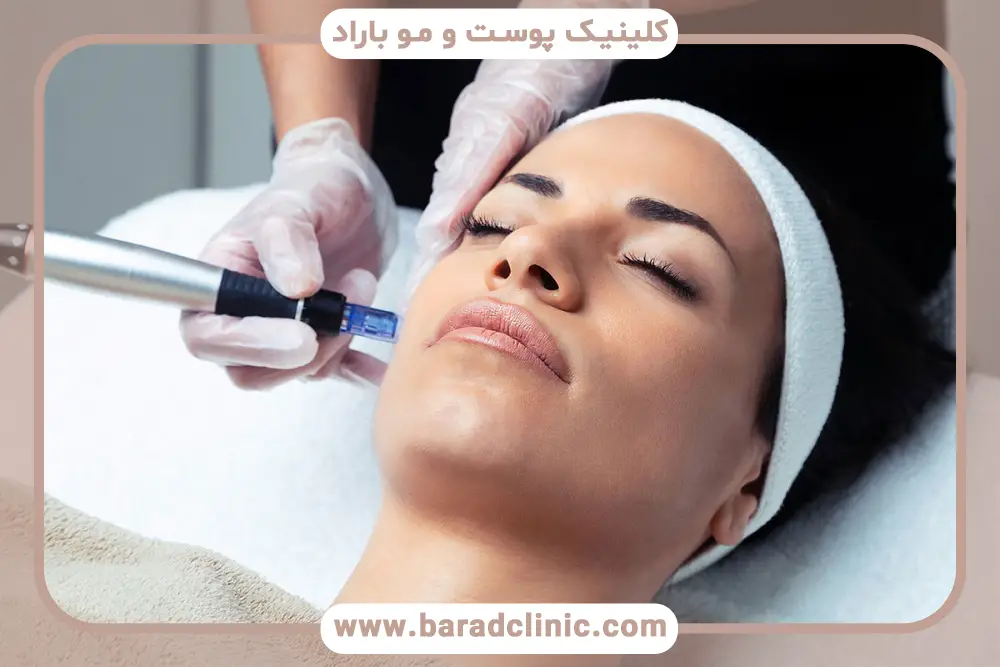 مزوتراپی چه عوارضی دارد