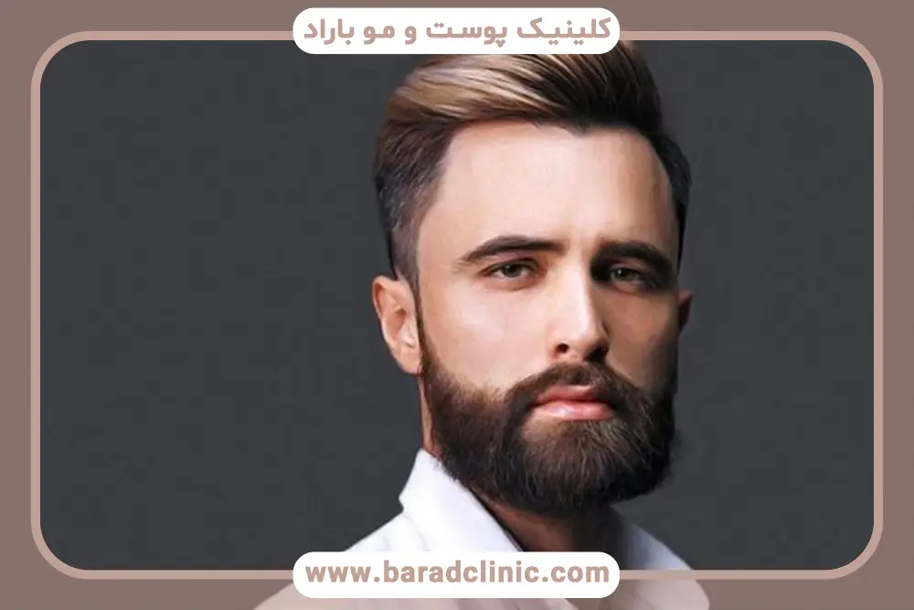قیمت کاشت ریش کامل