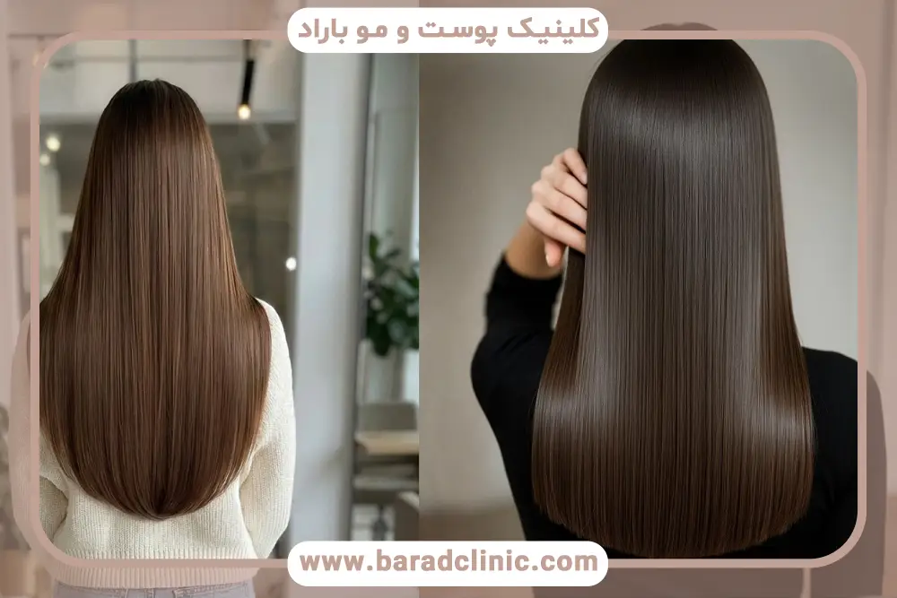 بوتاکس مو چیست