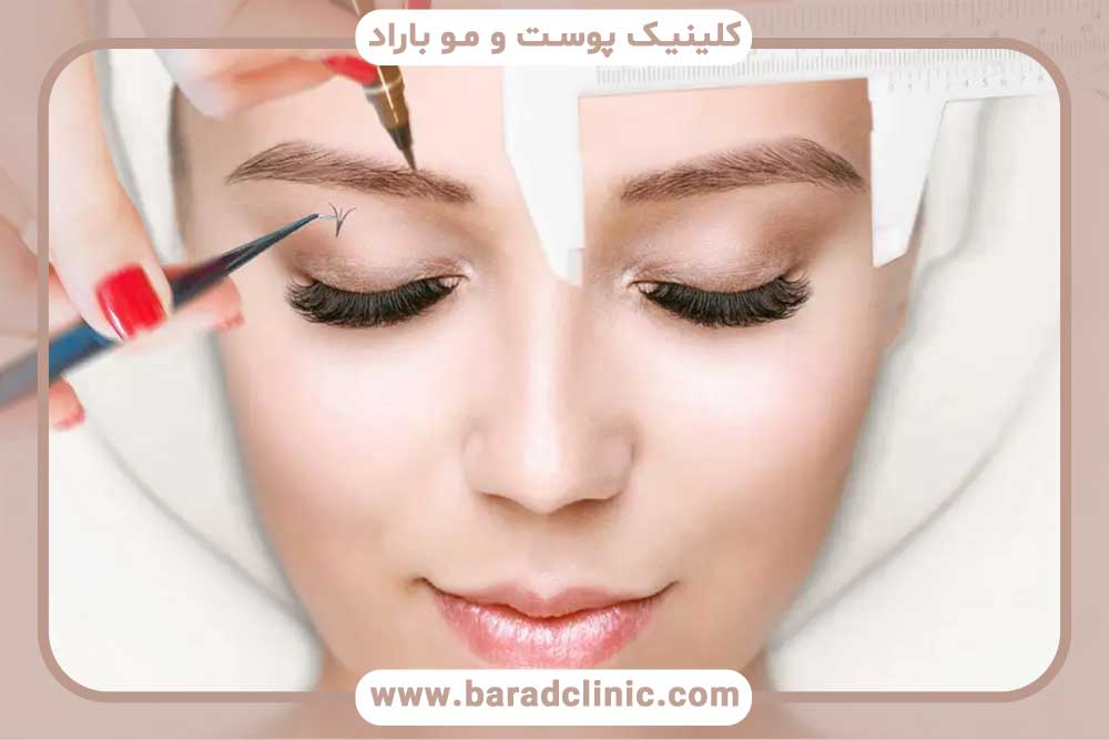 میکروکاشت ابرو