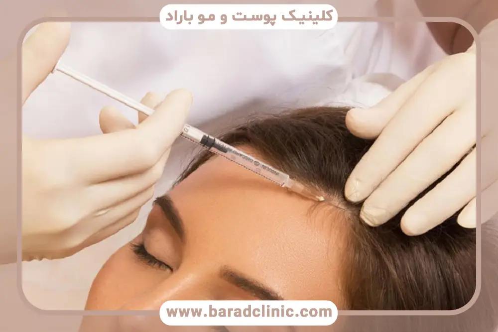 مزوتراپی چه فایده ای دارد