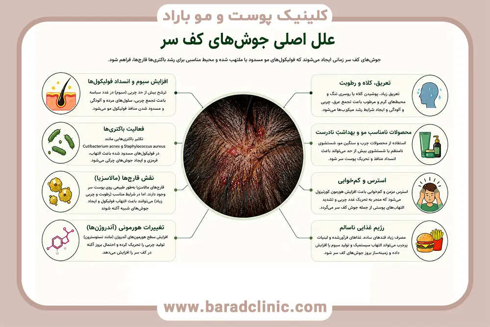 علل اصلی جوش های کف سر 