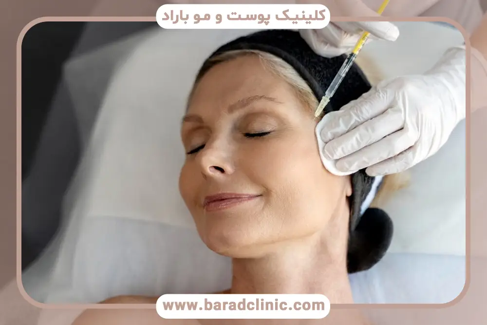 prp صورت قبل و بعد