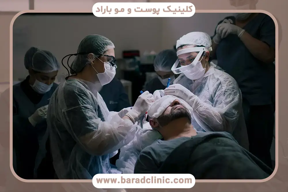 کاشت مو به روش جدید بدون جراحی