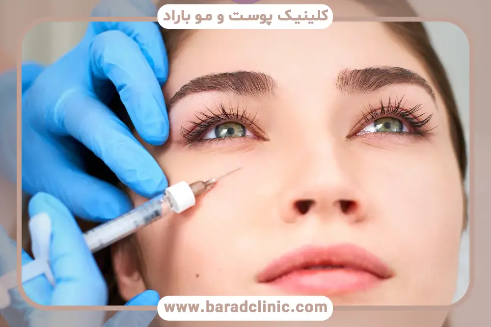 هزینه ی مزوتراپی زیر چشم