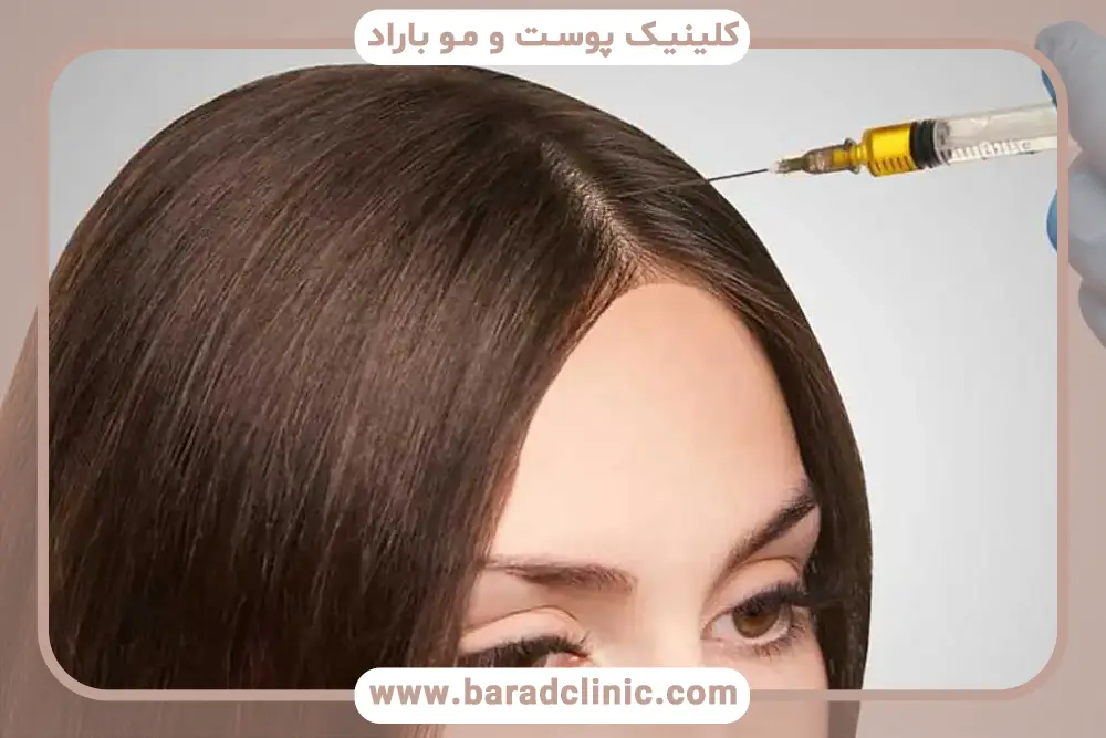 بهترین مرکز prp مو در تهران