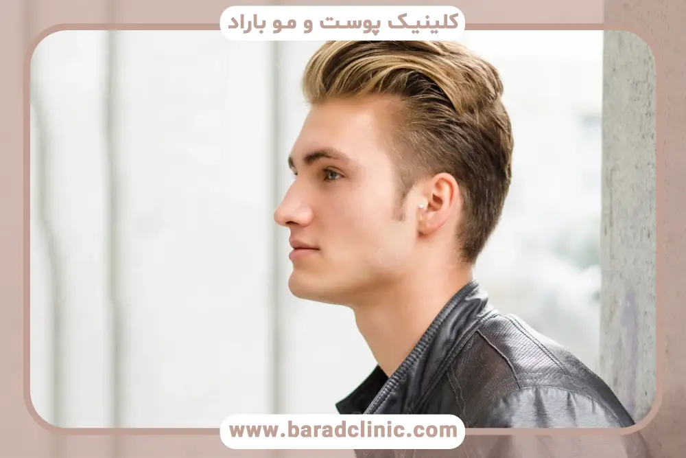 تعرفه کاشت مو