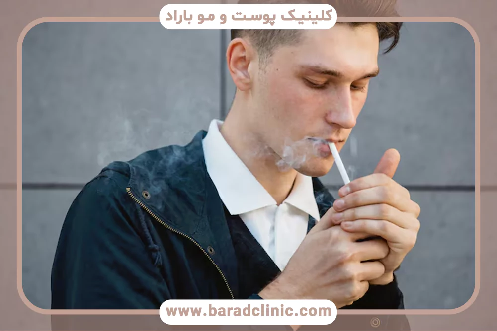 سیگار و ریزش مو