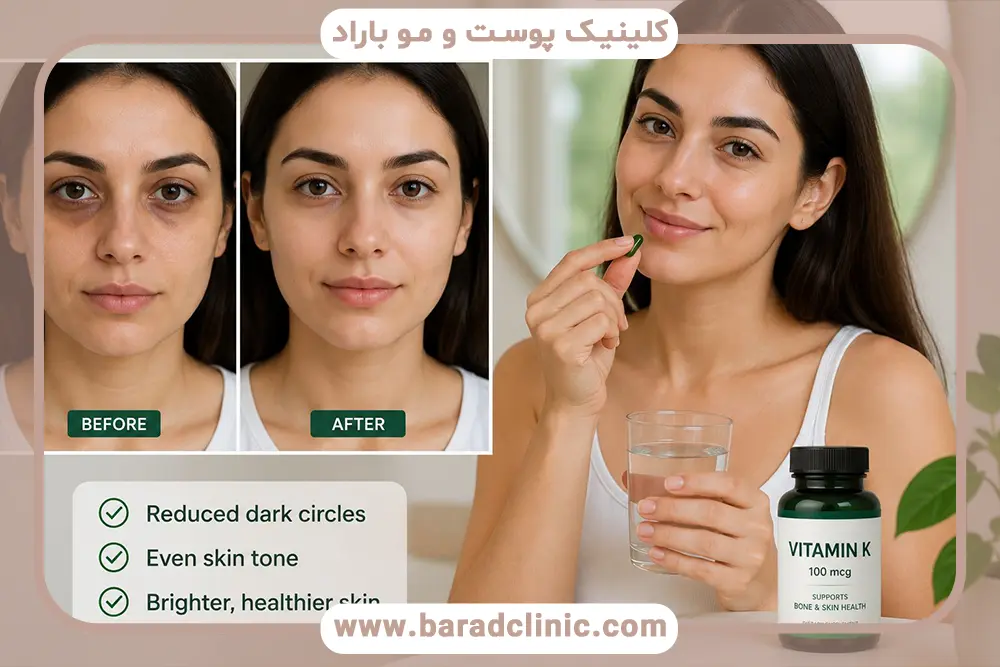 مصرف ویتامین k  و تاثیر ان بر تیرگی ها