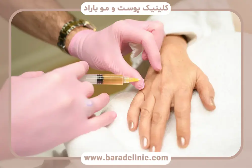 فاکتورهای انتخاب بهترین کیت prp