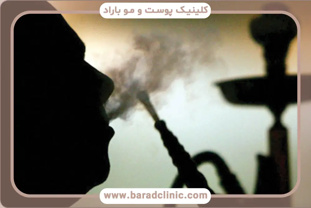 دلایل ممنوعیت قلیان بعد از کاشت مو