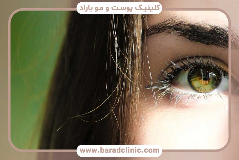 قرص برای ریزش ابرو