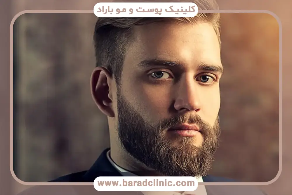 بررسی کلی تاثیر مزوتراپی ریش 