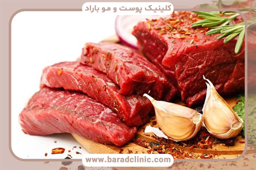 پرهیز از گوشت قرمز بعد از کاشت ابرو
