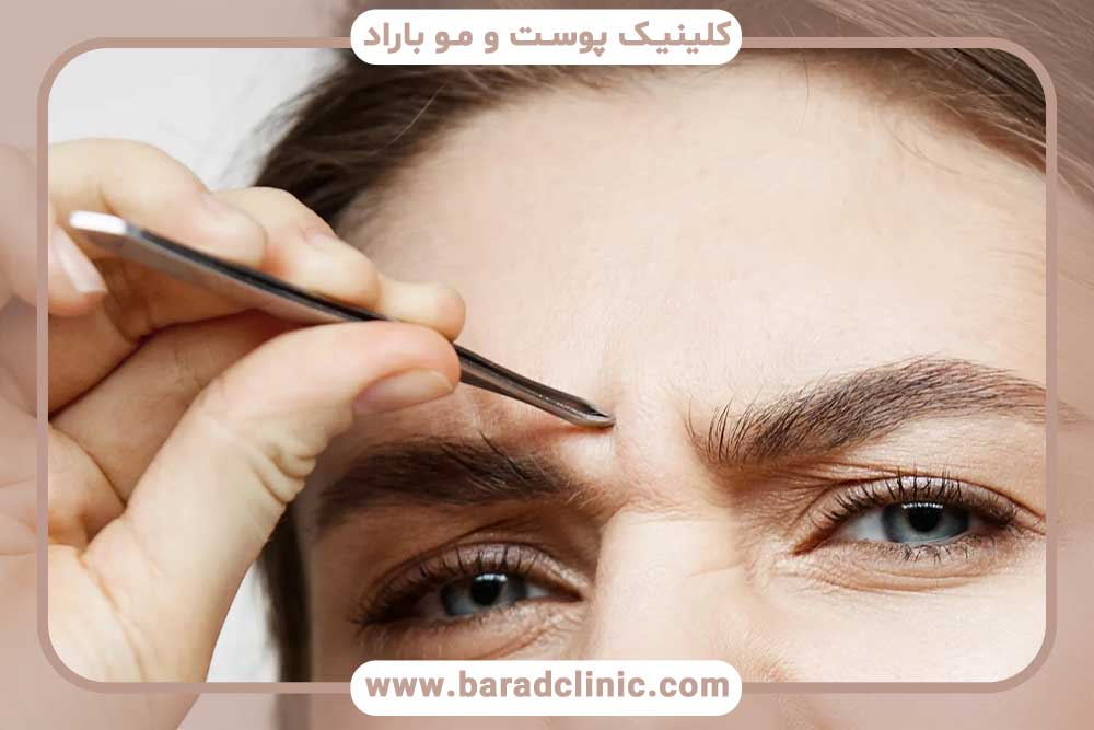 دوره نقاهت کاشت ابرو